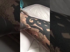 máquina del laser del pico segundo para el retiro del tatuaje